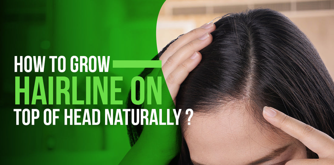 How to Grow Hairline On Top Of Head Naturally?