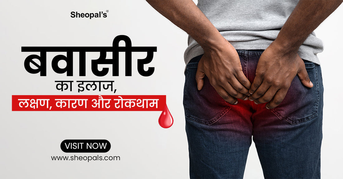 बवासीर का इलाज, लक्षण, कारण और रोकथाम