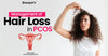Management of Hair Loss in PCOS (Polycystic Ovary Syndrome)