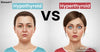 Hypothyroid vs Hyperthyroid: Causes, Symptoms and What's The Difference?