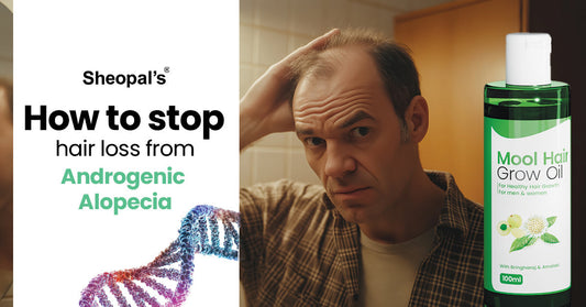Reverse Androgenic Alopecia Naturally: Proven Methods to Stop Hair Loss