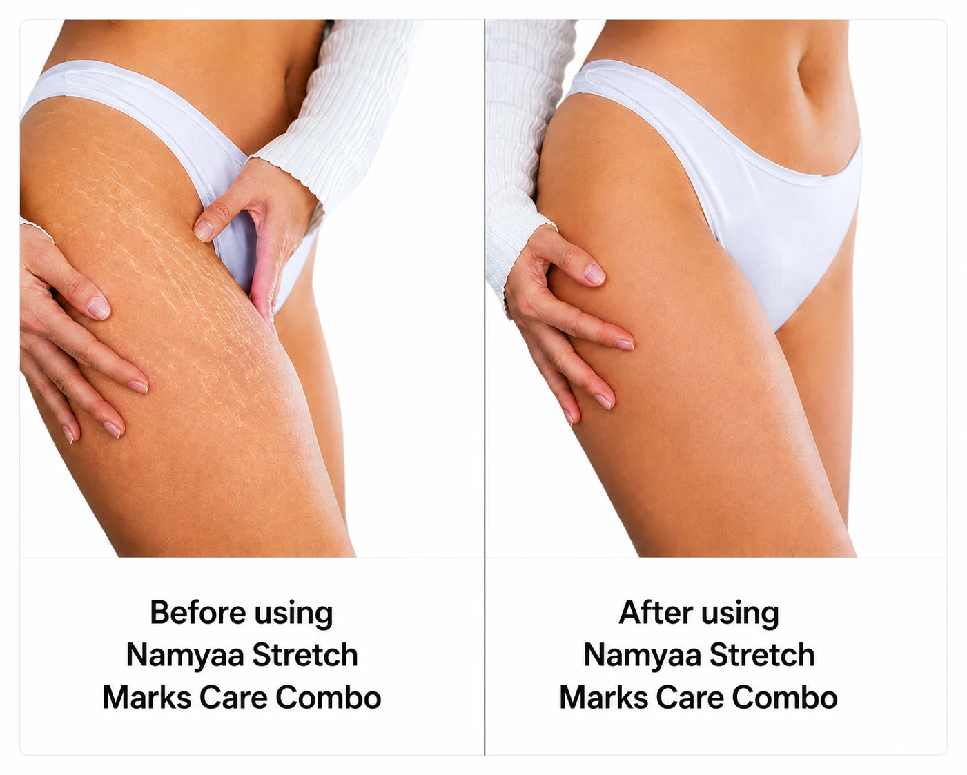 Sheopal's Stretch Mark Oil | 100ml
