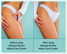 Sheopals Stretch Mark Oil thumbnail 6