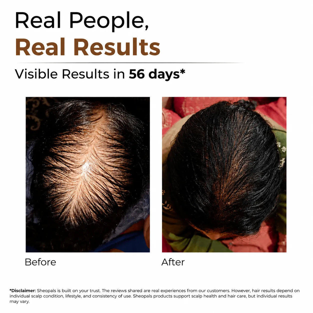 Sheopal's Hair Growth Serum