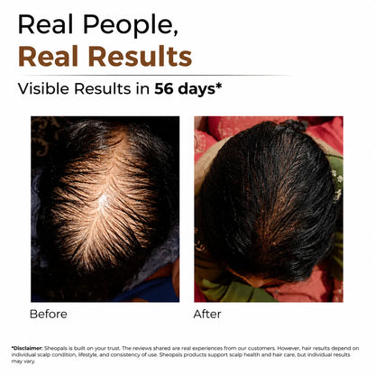 Sheopal's Hair Growth Serum