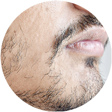 PATCHY BEARD