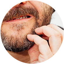 BEARD ITCH
