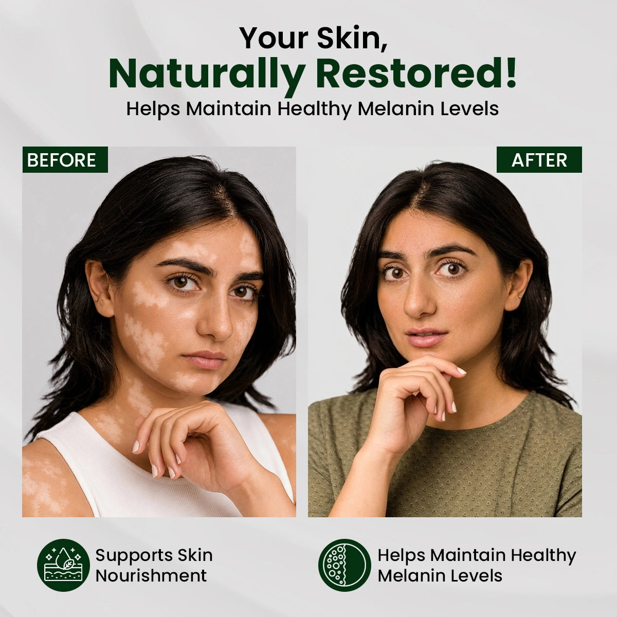 Sheopal's Vitiloma Combo | Skin Lotion + Capsules for Healthy-Looking Skin Tone