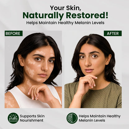 Sheopal's Vitiloma Combo | Skin Lotion + Capsules for Healthy-Looking Skin Tone