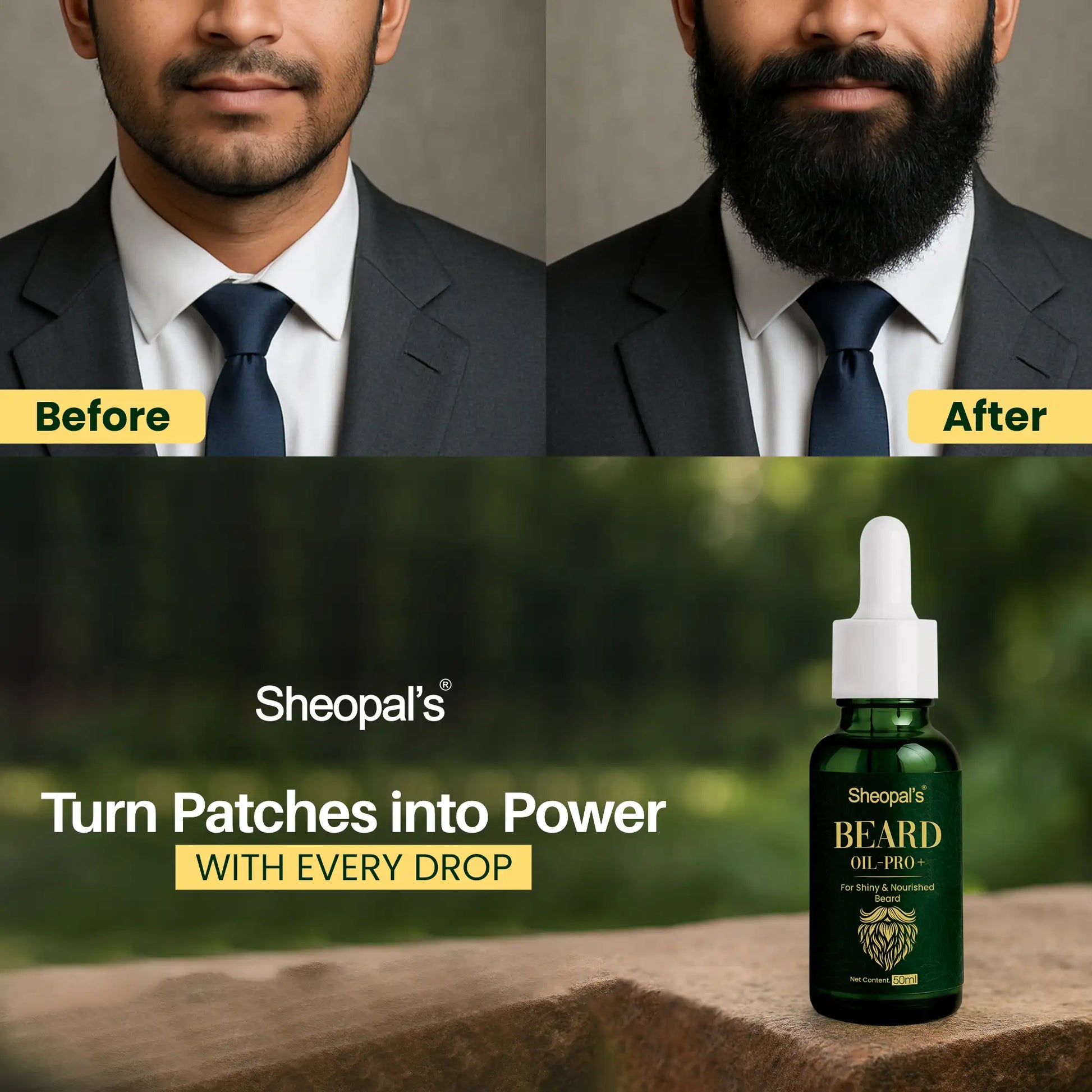 Best Beard Growth Oil