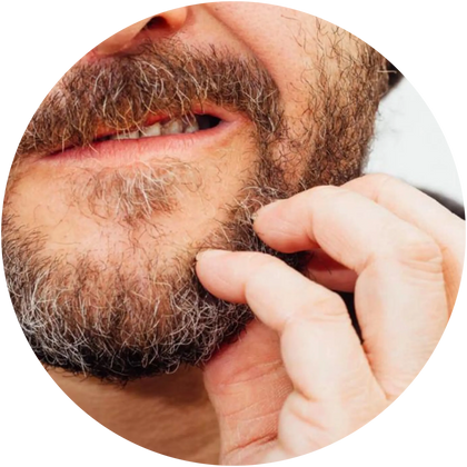 BEARD ITCH