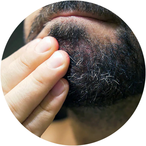 Dry beard