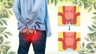 itching piles causes