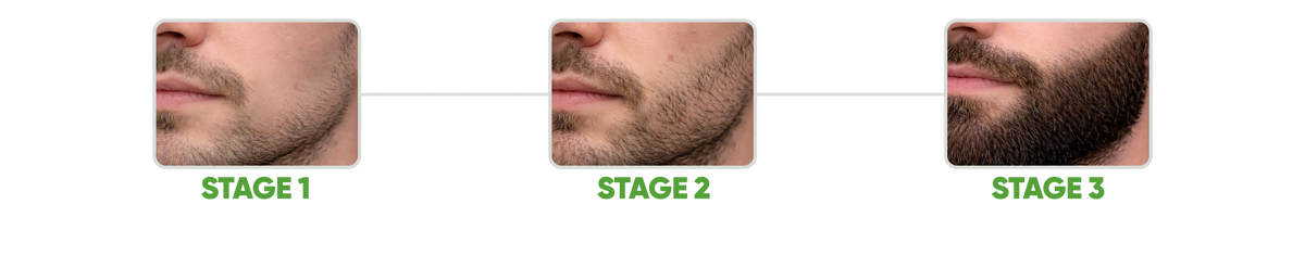 How Sheopal's Beard Serum works